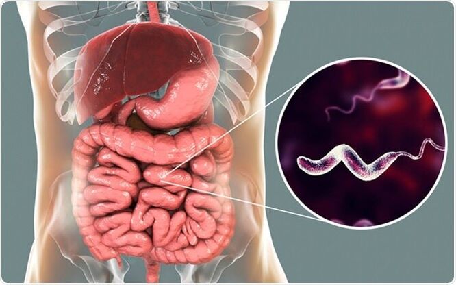 Paraziții eliberează toxine în organism, iar medicamentul Vermixin vă va ajuta să scăpați de ele! 